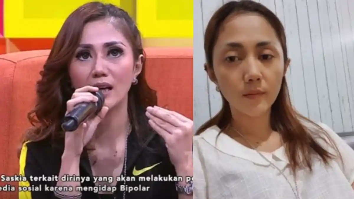 Aida Saskia Buka Suara Aksi Bunuh Dirinya Disebut Prank, Akui Telah 10 Kali Lakukan Aksi Bunuh Diri