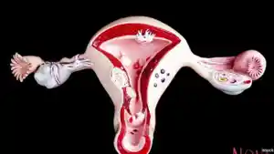 kanker-serviks-bahaya-bagi-wanita.jpg