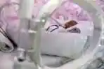 Dara Dirawat di NICU RSUD Tarakan