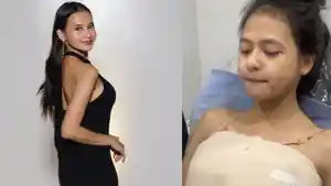 Cathy-Fakandi-pamer-before-dan-after-operasi-memperbesar-payudara.jpg