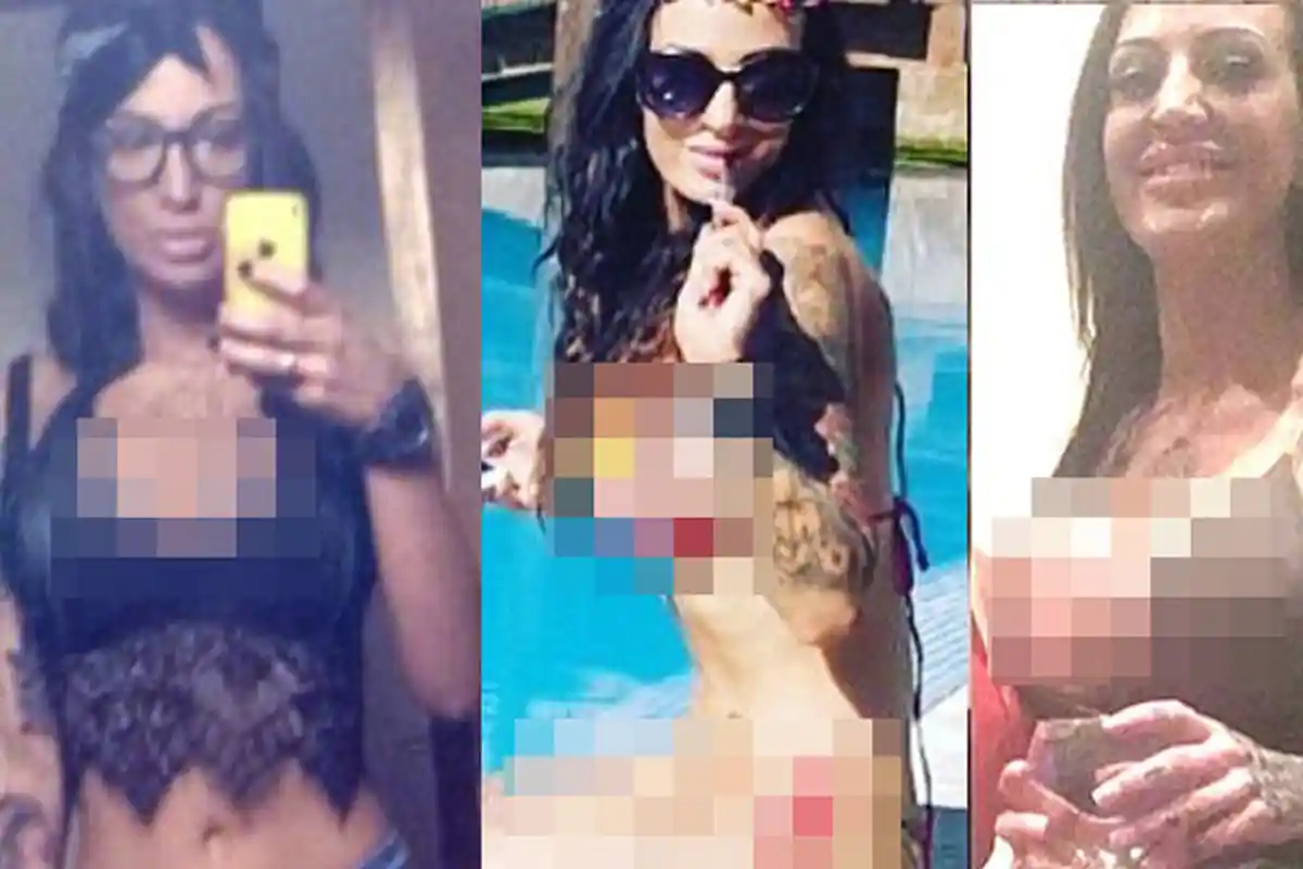 Kasihan! Habiskan Puluhan Juta Untuk Perbesar Payudara, Tapi Implannya Pecah