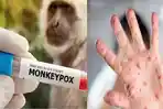 mengetahui-apa-itu-kasus-Monkeypox.jpg