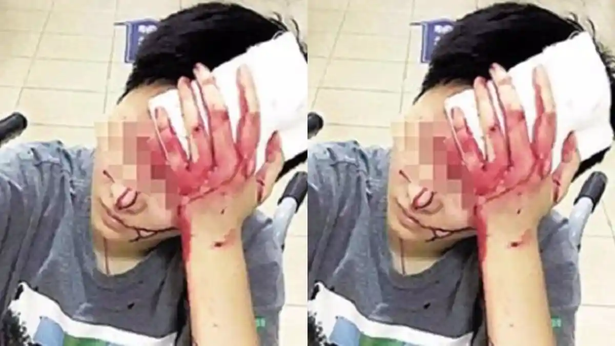 Astaga! Cuma Karena Hal Sepele, Kurir Makanan Tega Pukul Kepala Pelanggan Hingga Berdarah-darah!