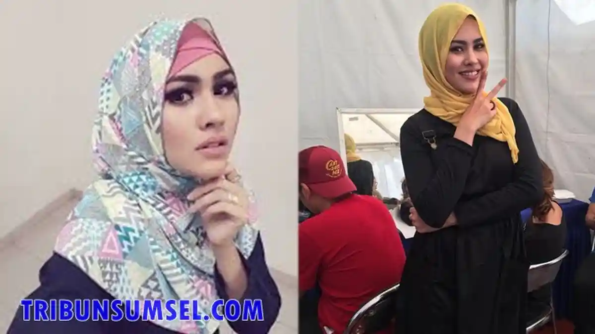 Jadi Korban Kecelakaan, Kartika Putri Unggah Postingan Begini, Ya Ampun Kasihan Kak!