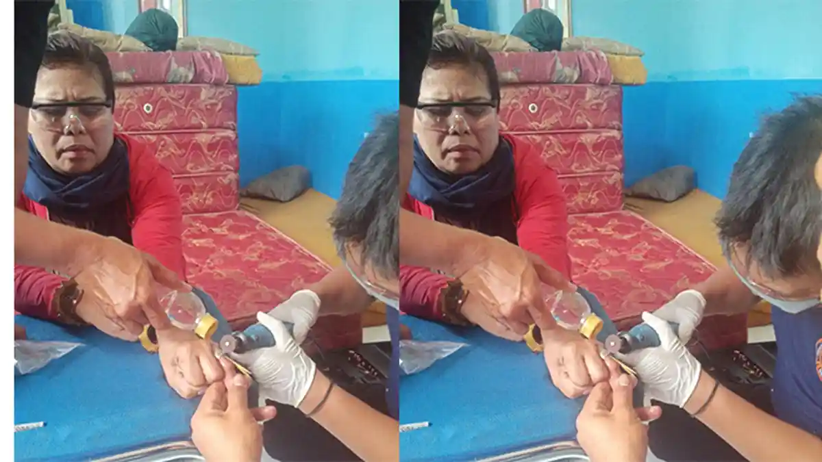 Petugas Damkar Cimahi Berhasil Lepaskan Dua Cincin Tembaga di Jari Manis Ibu Omey yang Tersangkut
