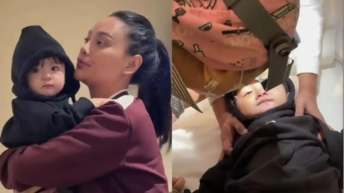 Kondisi Mata Andrew Setelah Heboh Dicurigai Juling, Erika Carlina Spill ...