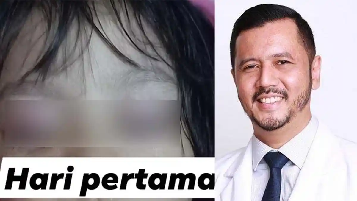 Viral Postingan Anak Kecil Belekan Gara-gara Sering Main HP, Ini Penjelasan Dokter Mata