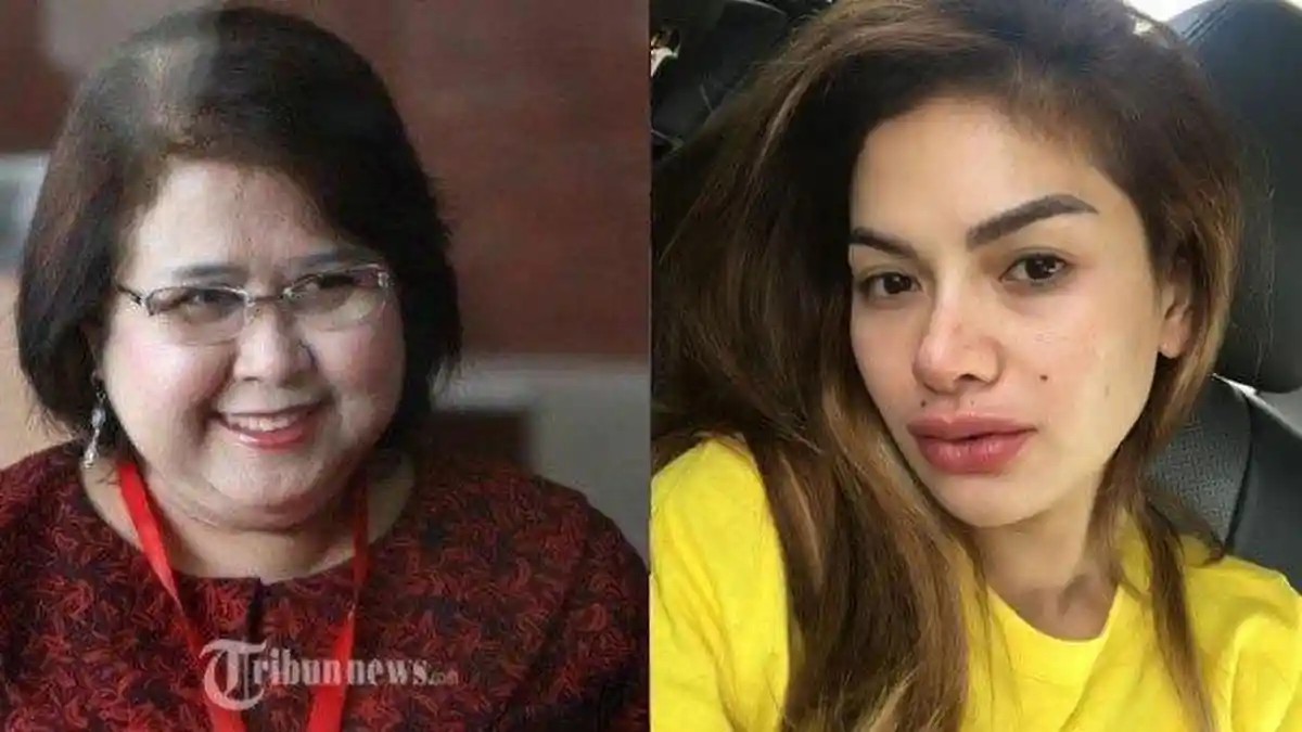 Hadapi Nikita Mirzani, Kondisi Elza Syarief DropBerat,Perlu Pendampingan Psikolog: Saya Korban