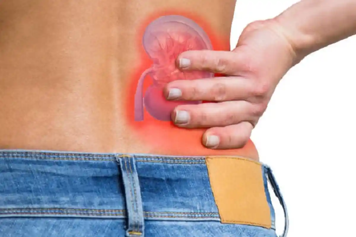 6 Gejala Batu Ginjal yang Sering Dianggap Remeh: Demam Hingga Mual, Berikut Ini Tips Pencegahannya