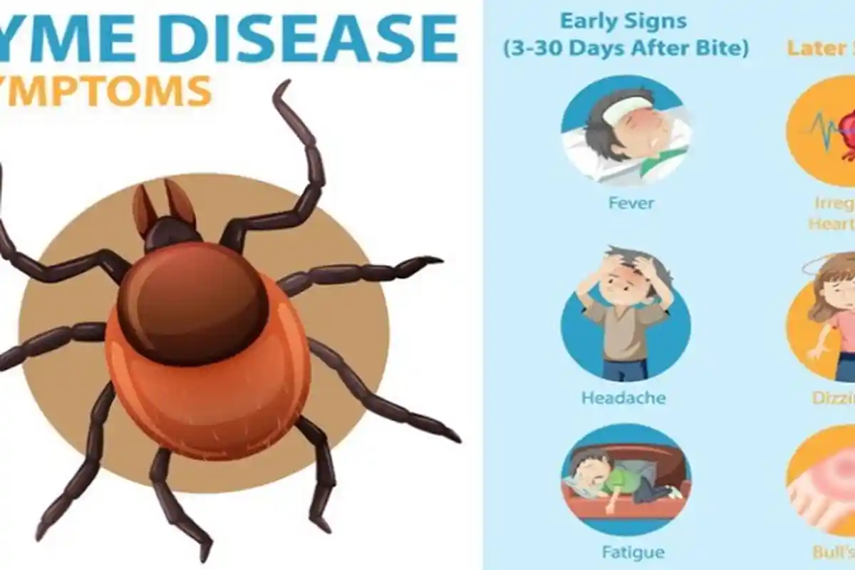 Kenali Gejala Penyakit Lyme,Penyebab Hingga Komplikasinya