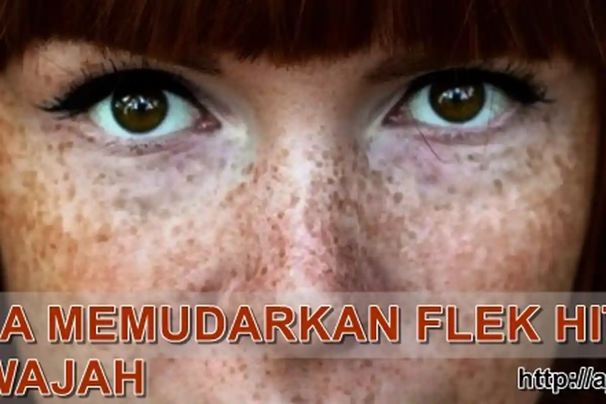 10 Bahan Alami Ini Berkhasiat Menghilangkan Flek Hitam di Wajah, Simak Caranya