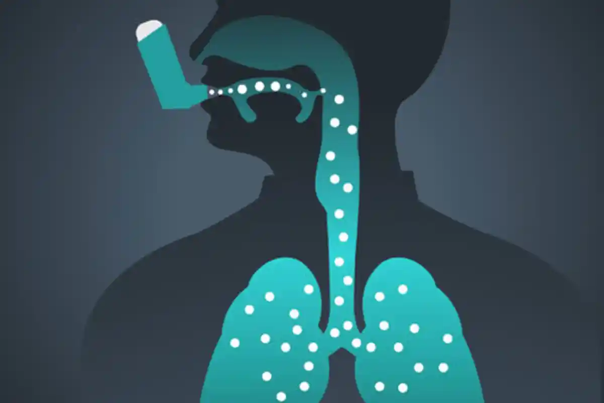 Serupa Menyerang Paru-Paru, Penderita Asma Lebih Rentan Terkena Virus Corona? Simak Penjelasannya