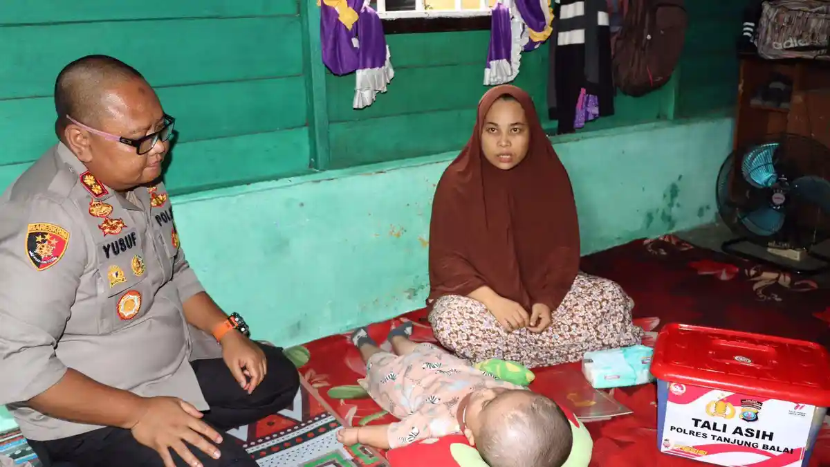 Kapolres Tanjungbalai Berikan Bantuan Tali Asih kepada Balita Penderita Hidrosephalus