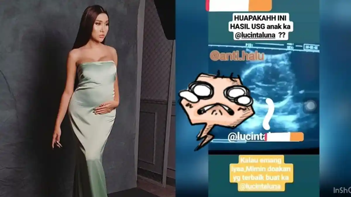 Beredar Video USG Lucinta Luna, Terungkap Gimana Kondisi Janinnya, Netizen: Dokternya Lebih Halu