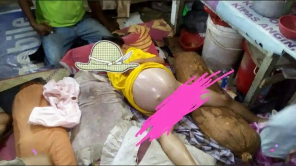 Duh Kasihan, Bocah Asal Sinjai Ini Menderita Perut Membesar, Butuh Uluran Tangan Anda