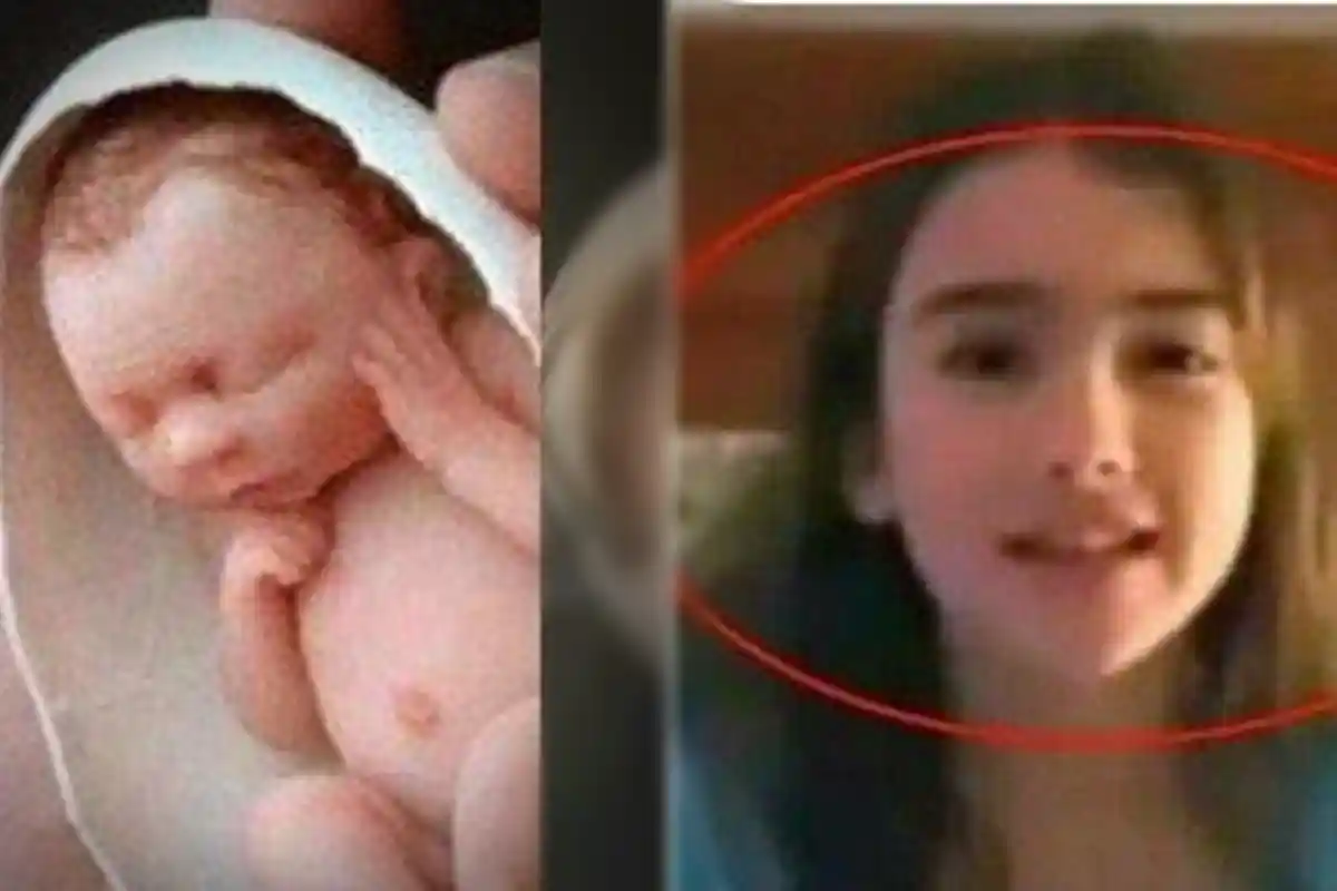 Masih Ingat Bayi Terkecil yang Pernah Hidup di Dunia? Kini Sudah Tumbuh Menjadi Gadis Cantik