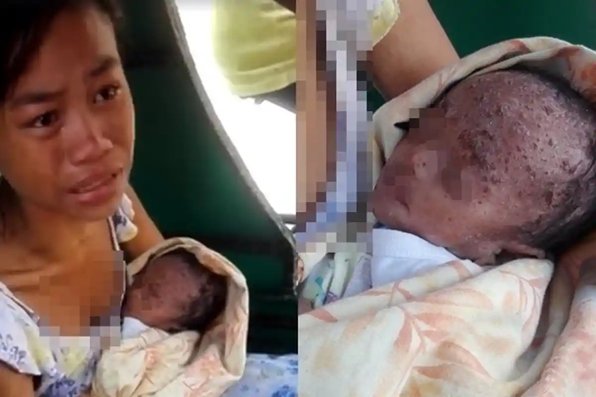 Menyayat Hati, Tak Punya Uang, Ditolak Pemerintah, Bayi ini Sakit Hingga Kondisi Mengenaskan