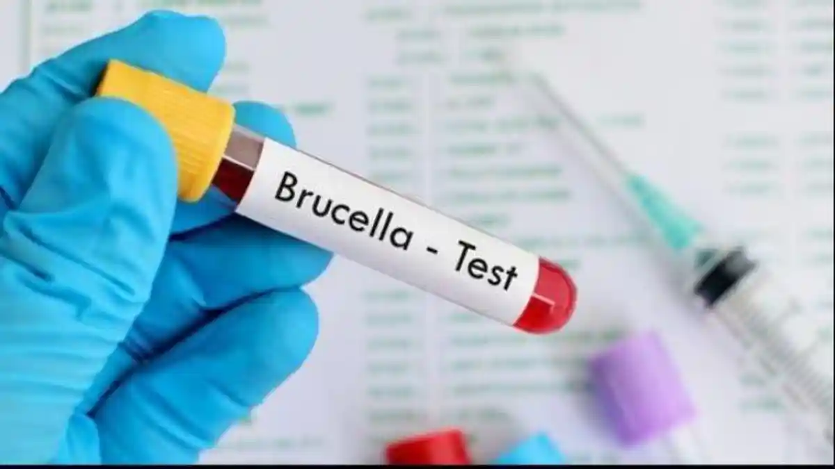 Mengenal Brucellosis, Infeksi Bakteri Karena Hewan, Berikut Gejalanya
