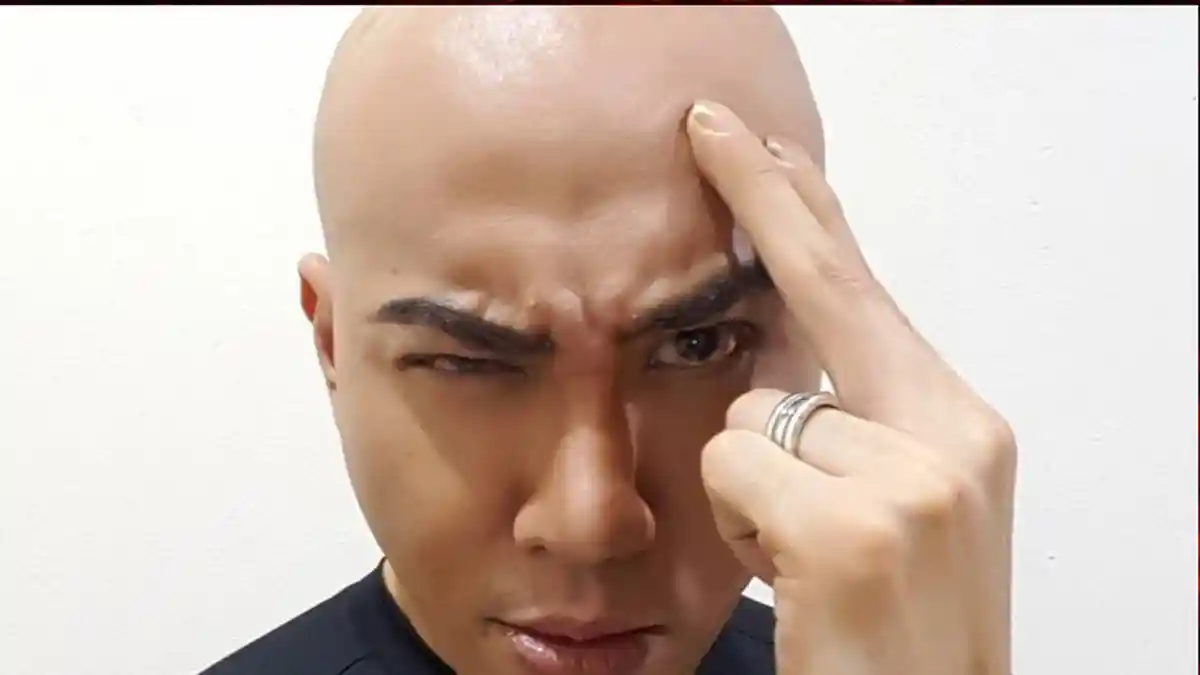 Simak Ulasan Terkait Badai Sitokin, Apa Itu? Ini Gejala yang Dialami Deddy Corbuzier