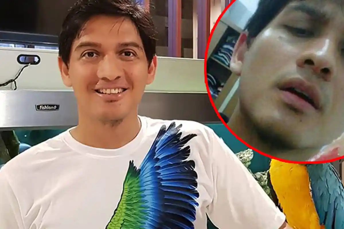 Astaga! Beredar Foto Lucky Hakim Dihisap sampai Berdarah, Netizen Antara Syok dan Geli