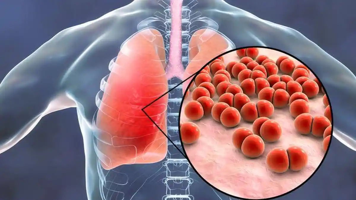 20 Ribu Anak-anak di China Dirawat di RS Akibat Pneumonia Misterius