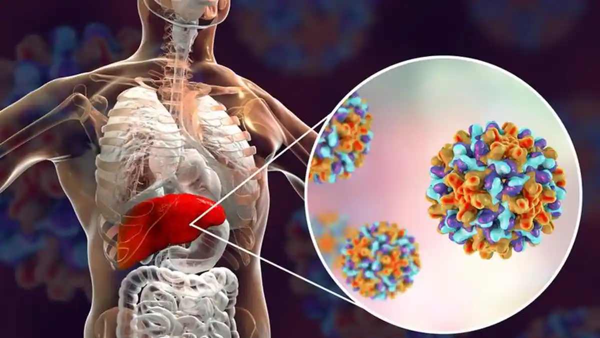 Kemenkes Minta Warga Waspada Penyakit Hepatitis Misterius