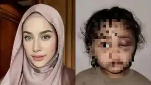 Anak-Aghnia-Punjabi-Dianiaya-Pengasuhnya.jpg