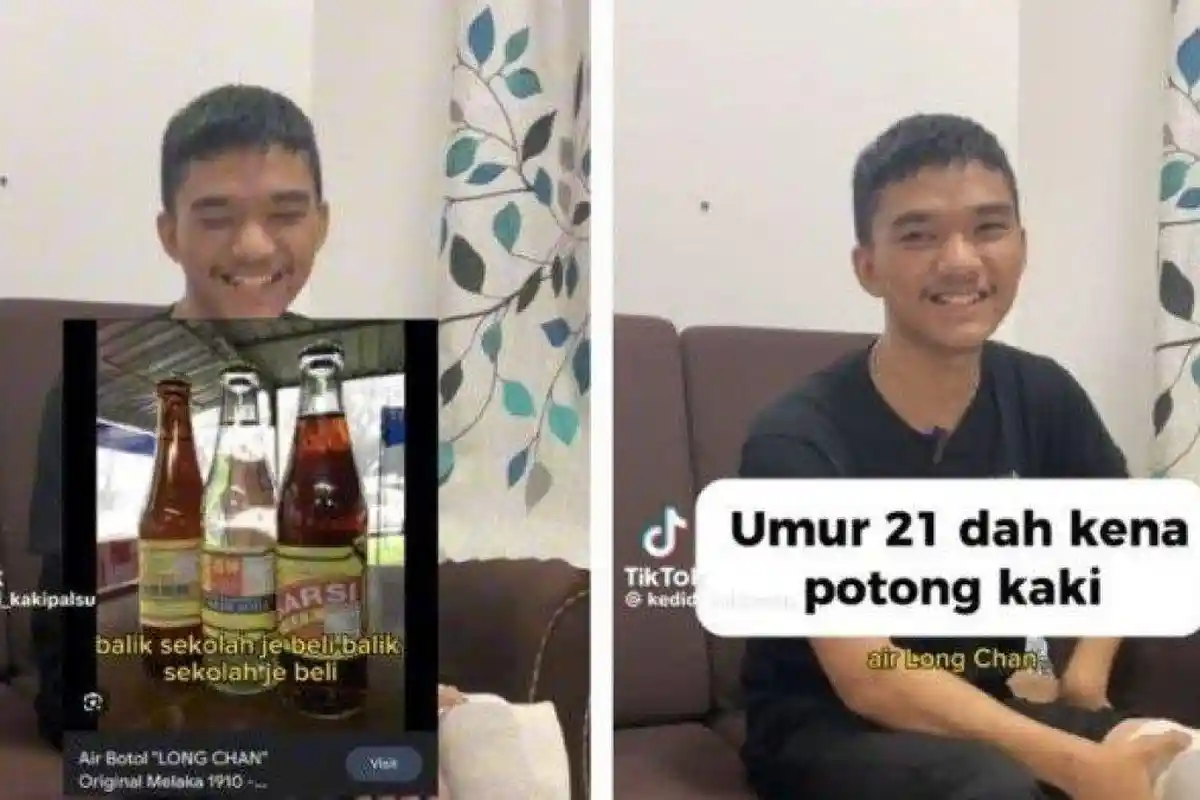 Kisah Pilu Pemuda 21 Tahun Idap Diabetes hingga Kaki Terpaksa Diamputasi Gegara Candu Minuman Ini