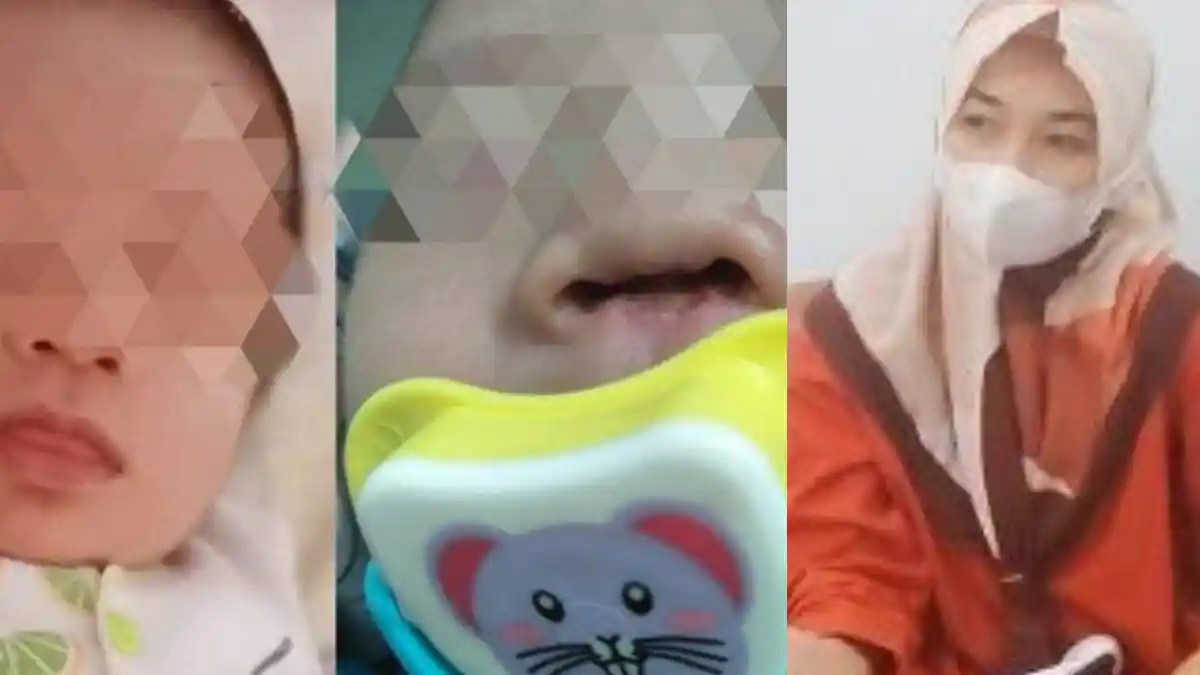FAKTA Bayi 1 Bulan 6 Hari Diduga Korban Malapraktik di Konawe, Tulang Hidung Hilang, RSUD Membantah