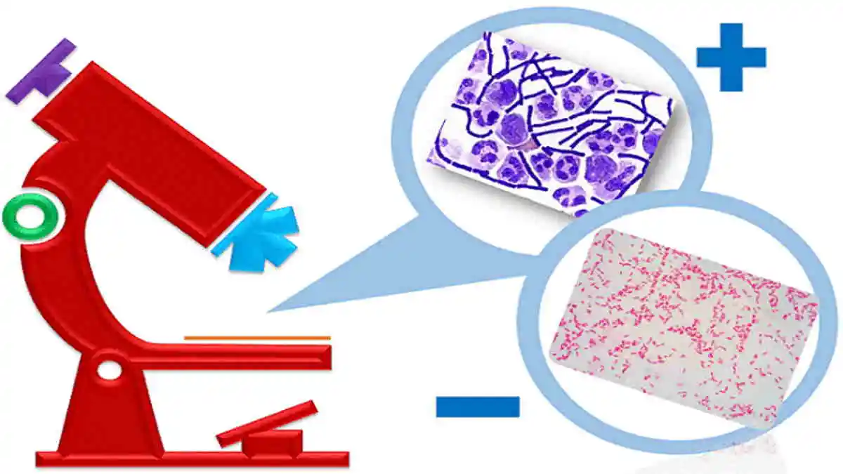 Apa Itu Pewarnaan Gram?, Materi Belajar Biologi Kelas 10