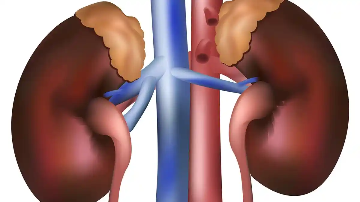 Apakah Gagal Ginjal Bisa Sembuh? Ini Alternatif Pengobatan Selain Cuci Darah