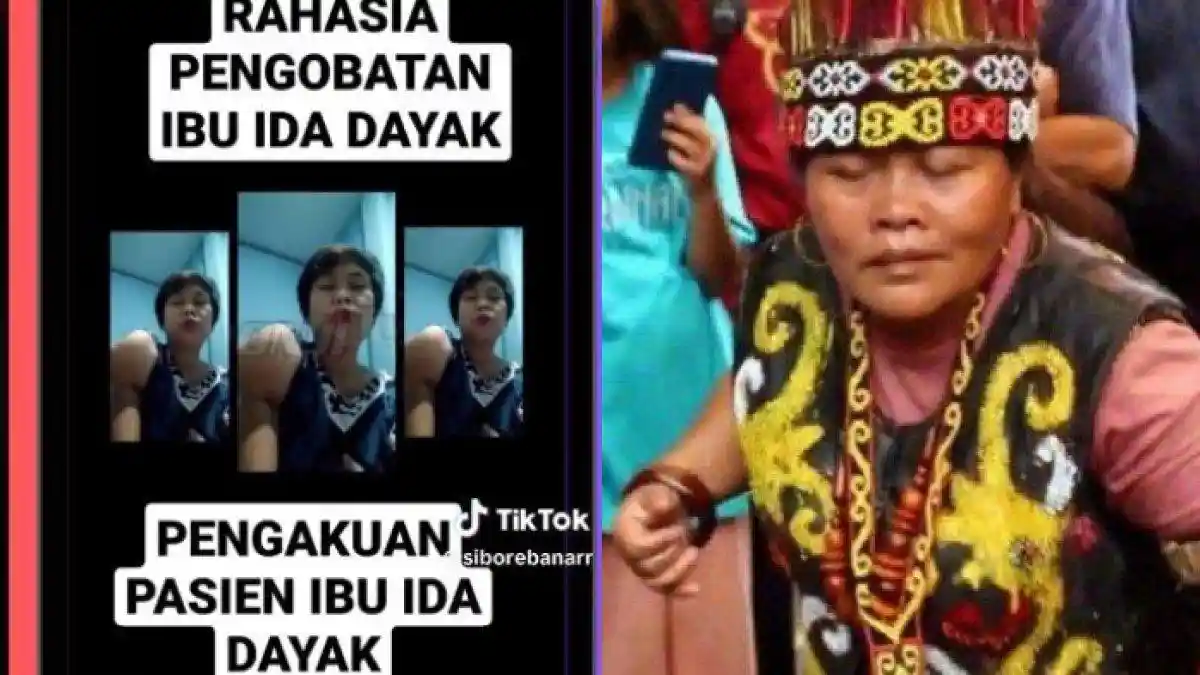 Videonya Viral Tapi Tangan Masih Bengkok, Pasien Ida Dayak Kini Tagih Janji: Hasilnya Masih Begini
