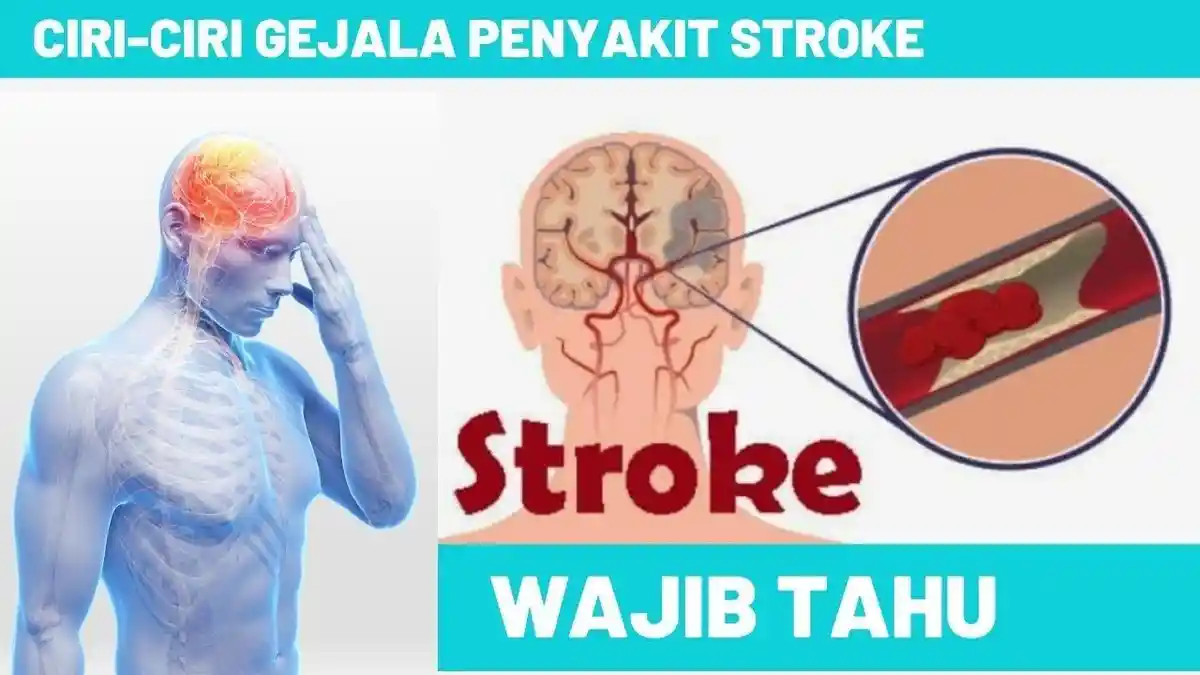 5 Cara Mengobati Stroke Dengan Obat Herbal Ashwagandha, Seledri, Sembung, Dijamin Cepat Sembuh