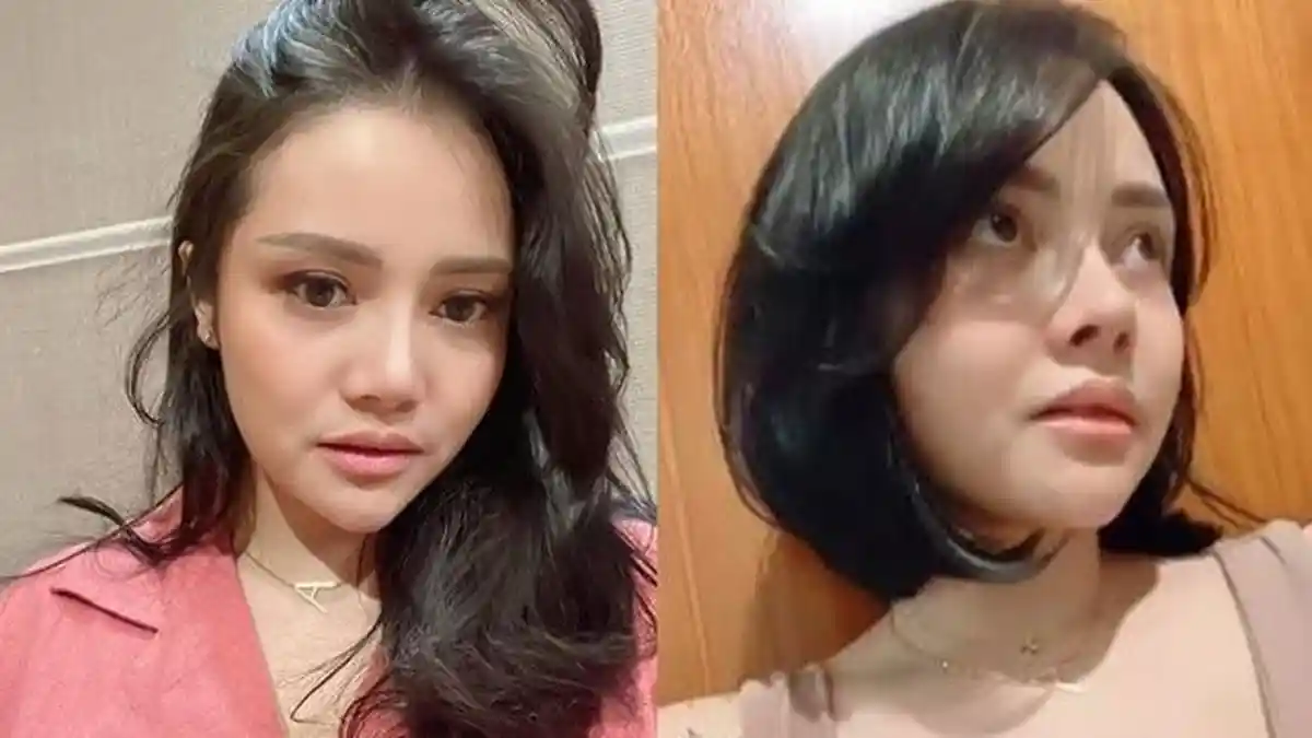 Bentuk Wajah & Hidung Mawar AFI Berubah Drastis Seusai Operasi Rahang Pipi, Gerak-gerik Ikut Disorot