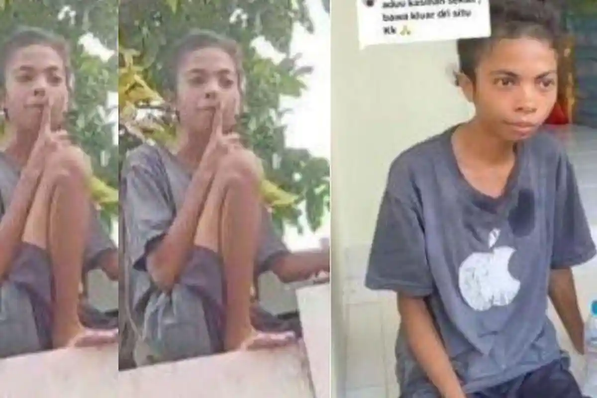 Kurusnya Kondisi Isabela Elu ART Wanita yang Dikurung Hingga Tak Dikasih Makan Majikan di Jakbar