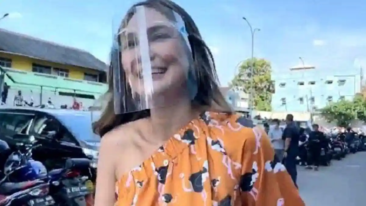 Gowes di Bali Saat Cedera Kaki, Luna Maya Alami Kecelakaan Hingga Pelipis Robek