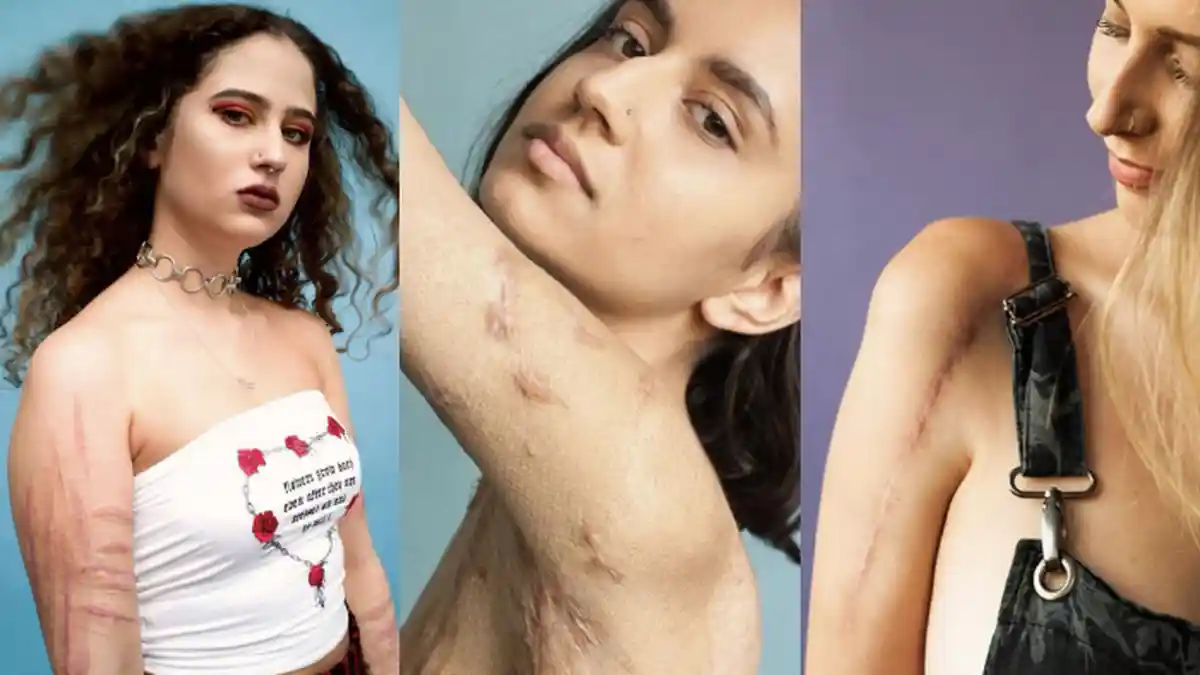 9 Potret Model-model Tak Biasa yang Menampilkan Ketangguhan dan Keberanian Hidup Mereka