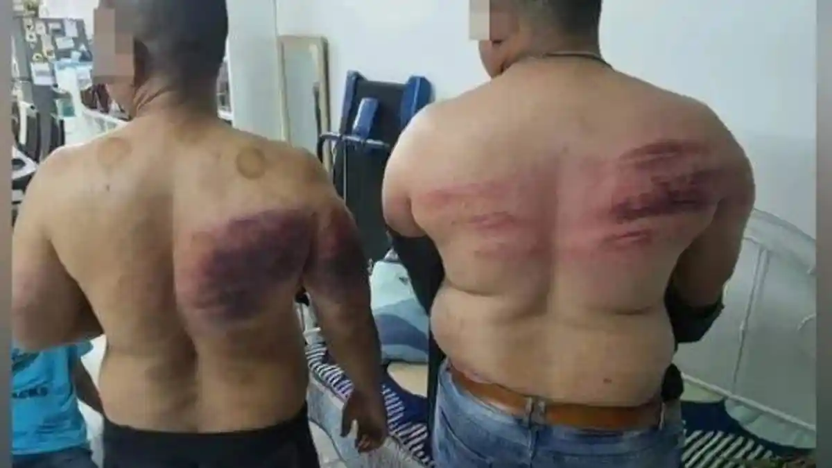 Karena Berpuasa, Dua Satpam Disiksa Majikan