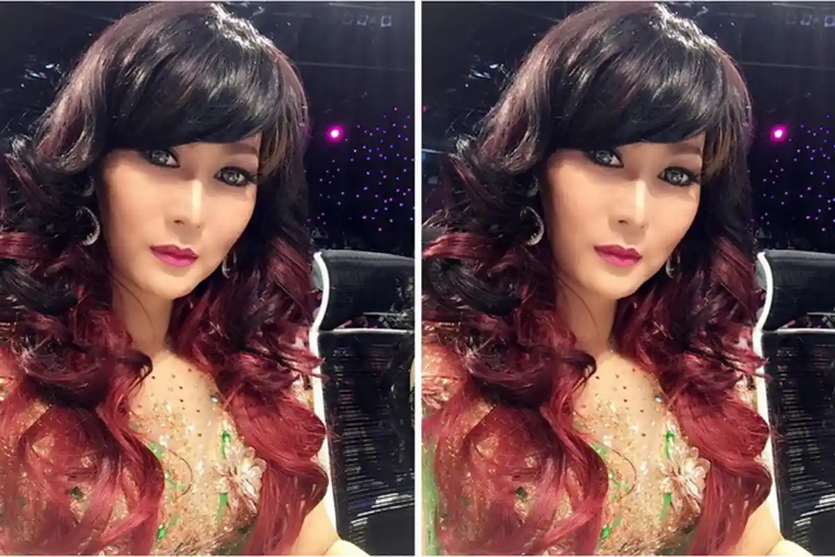 Lima Jarum Tertancap di Wajah Inul Daratista, Tubuhnya Terkapar dengan Balutan Handuk