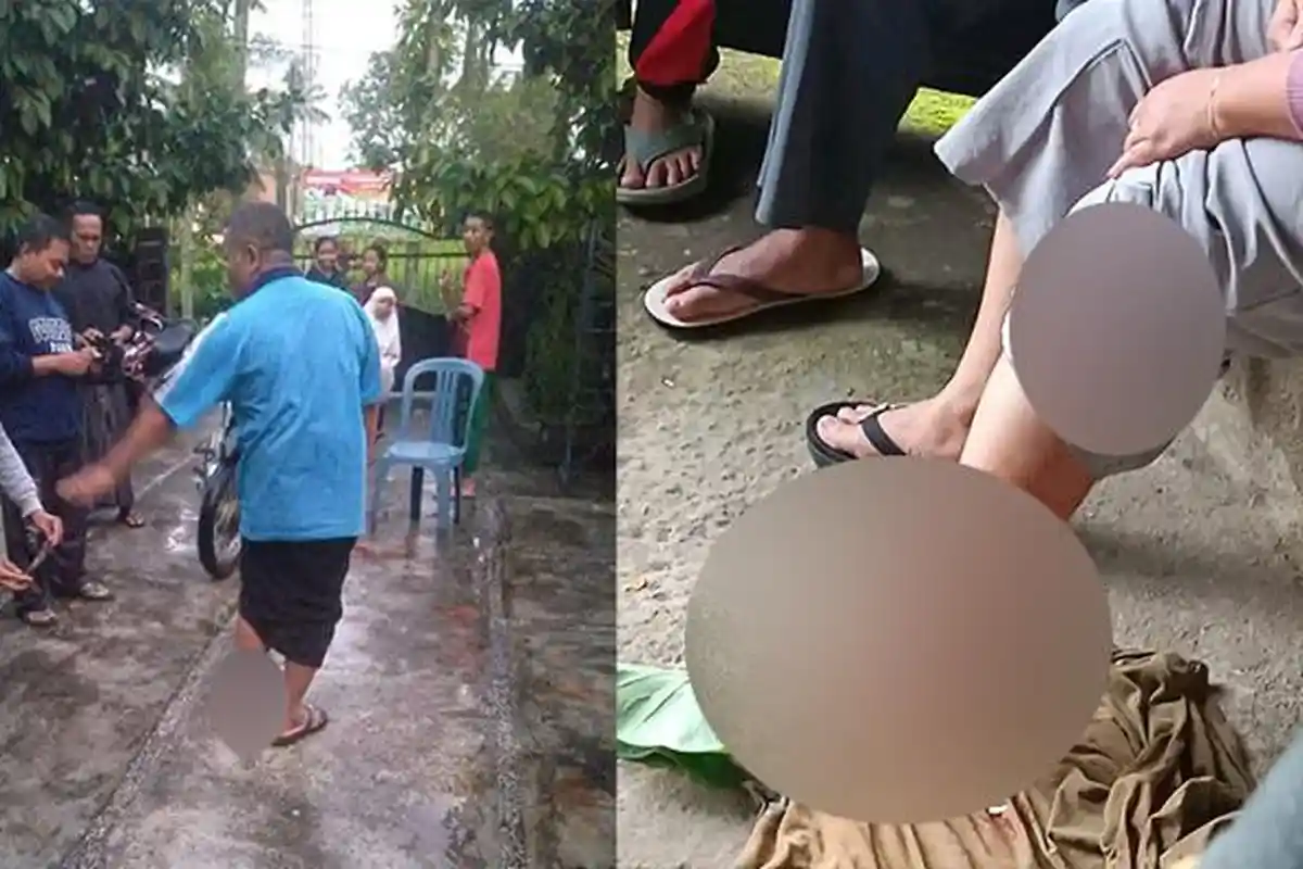 Monyet di Lombok Timur Serang Warga di Pemukiman, Korban Alami Luka Cakar di Punggung Hingga Kaki