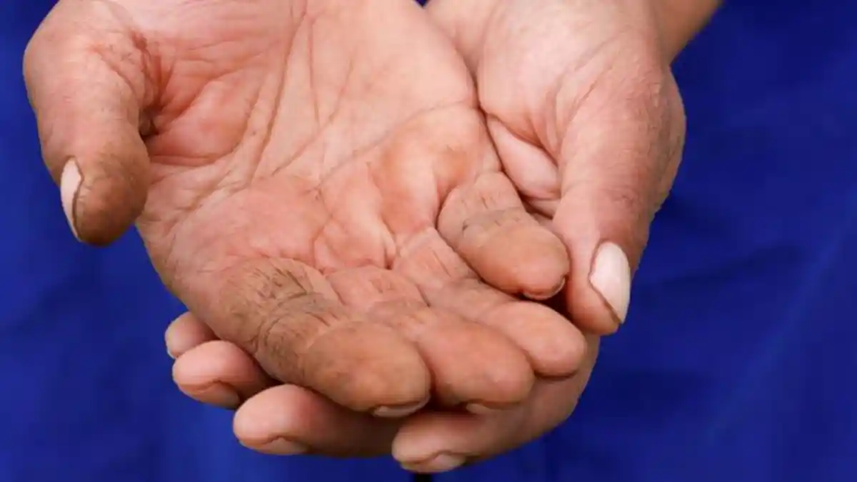 VIRAL - Seorang pengemis Meninggal Dunia Dengan Segepok Uang Tabungan Rp 15,4 Miliar