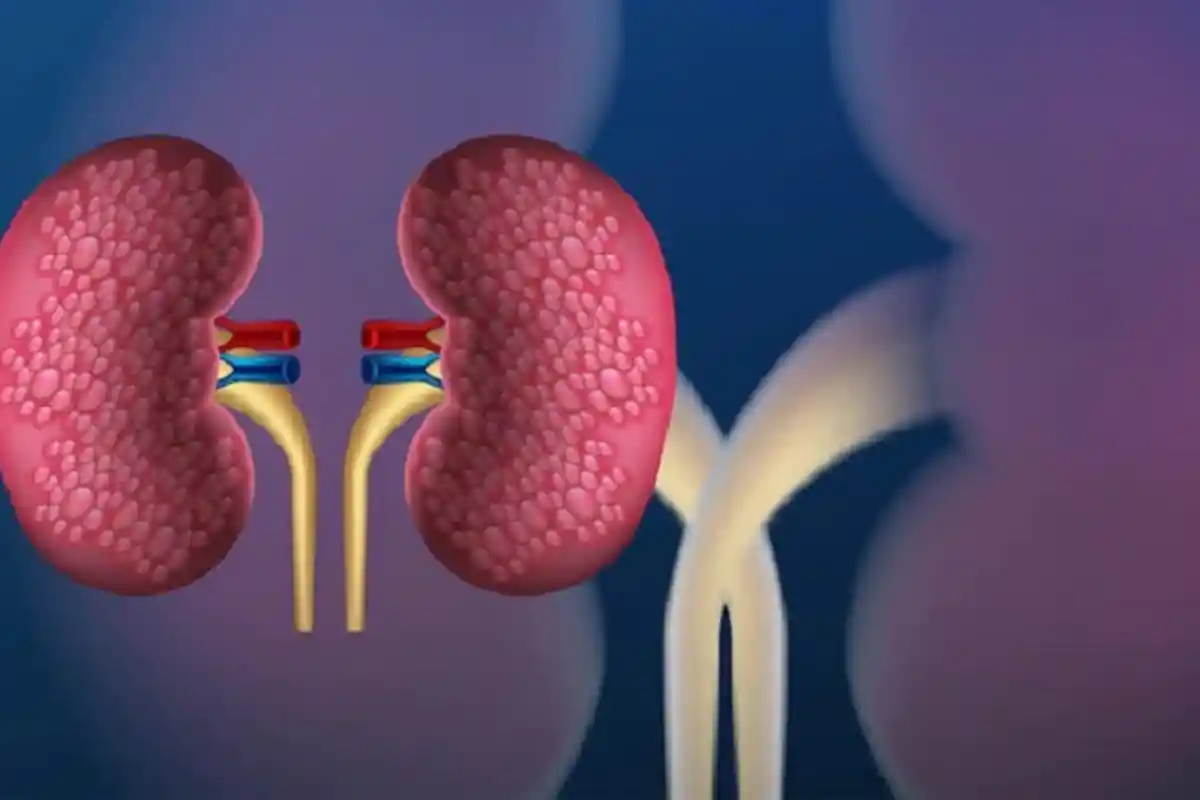 14 Tanda Ginjal Anda Sudah Terganggu, Mulai Dari Mudah Lelah hingga Urin Berbusa