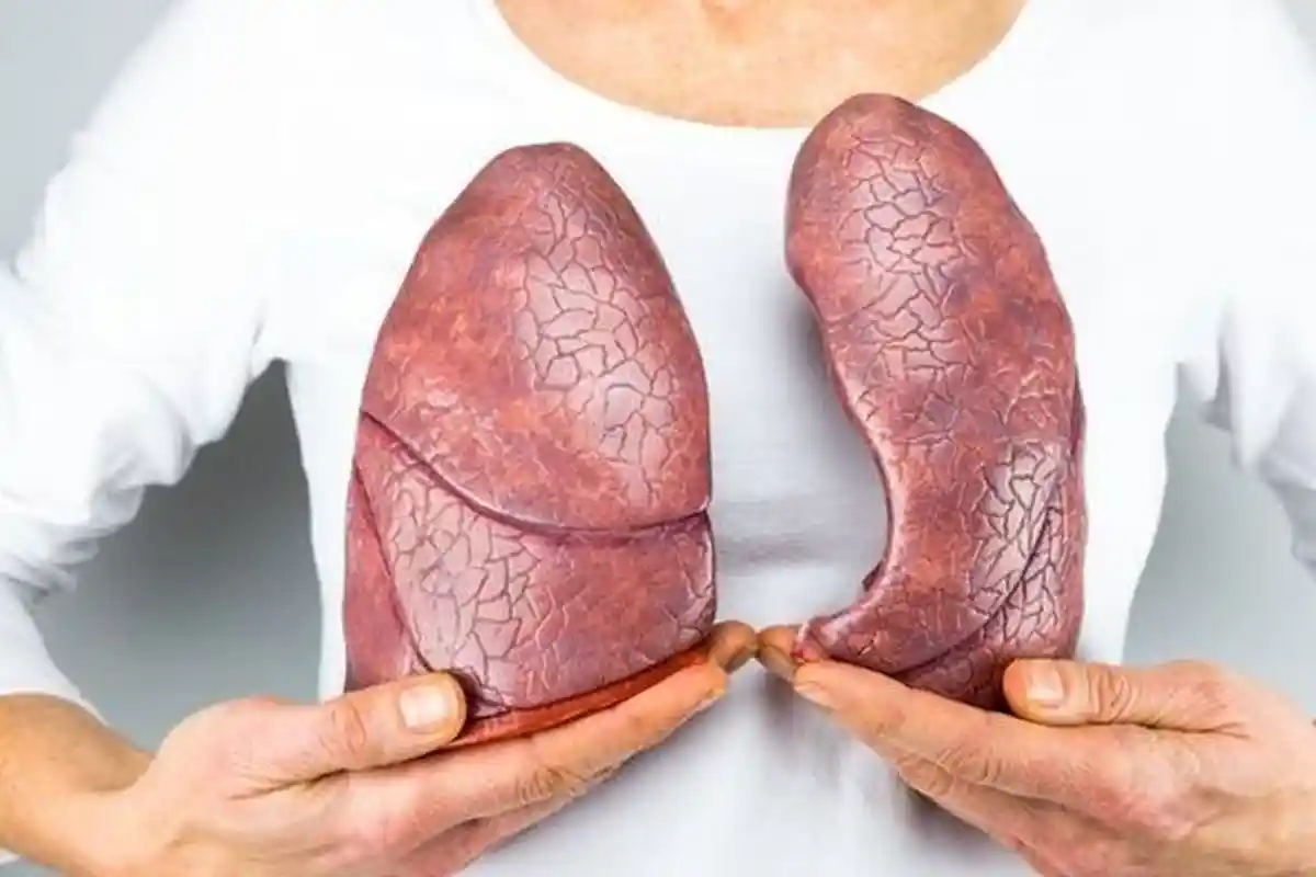 Mengenal Kanker Paru-paru: Kanker Penyumbang Kematian Terbesar