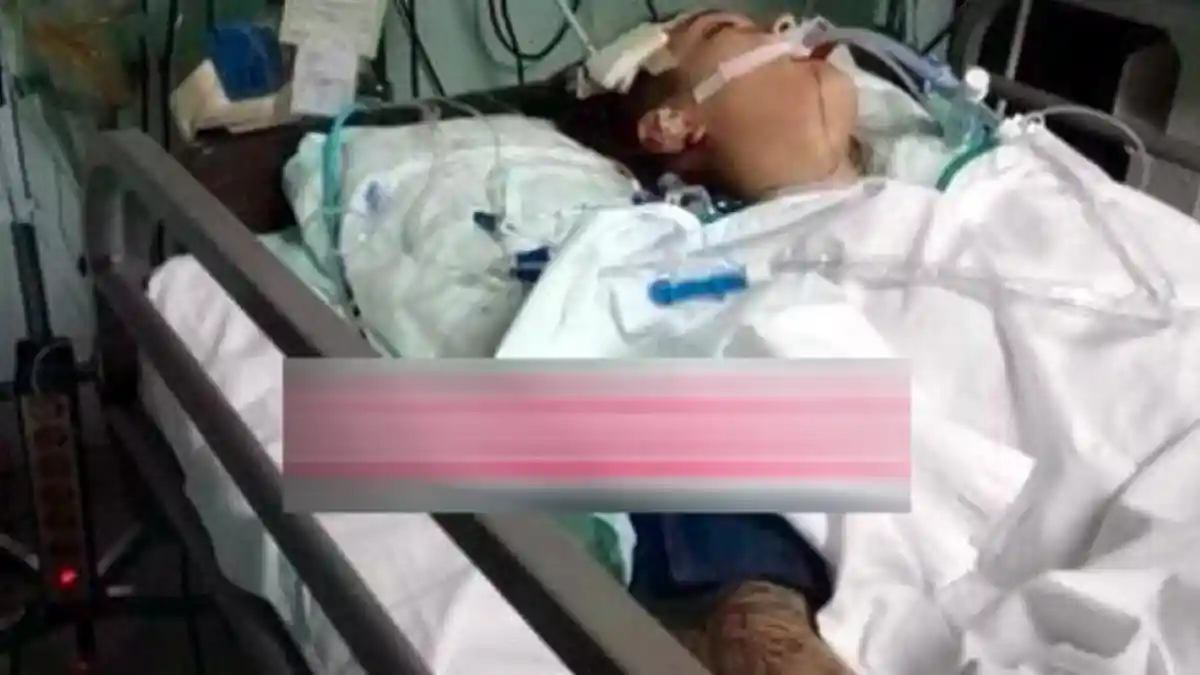Ada Penyumbatan di Bagian Otak Usai Kecelakaan, Teman Sheila Marcia Dibius Selama Tiga Hari