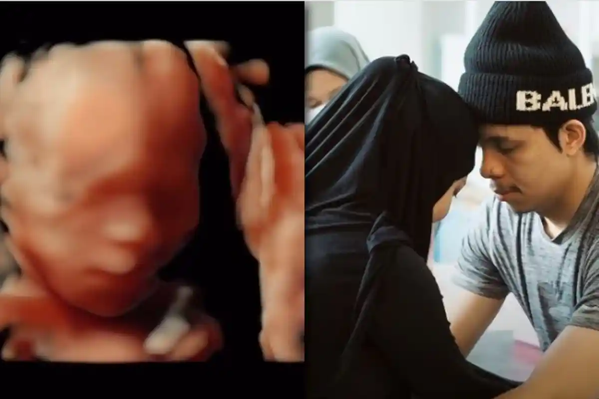 Kondisi Bayi Aurel Saat USG Diperlihatkan Atta Halilintar, Reaksi Mertua Disorot: Ya Allah