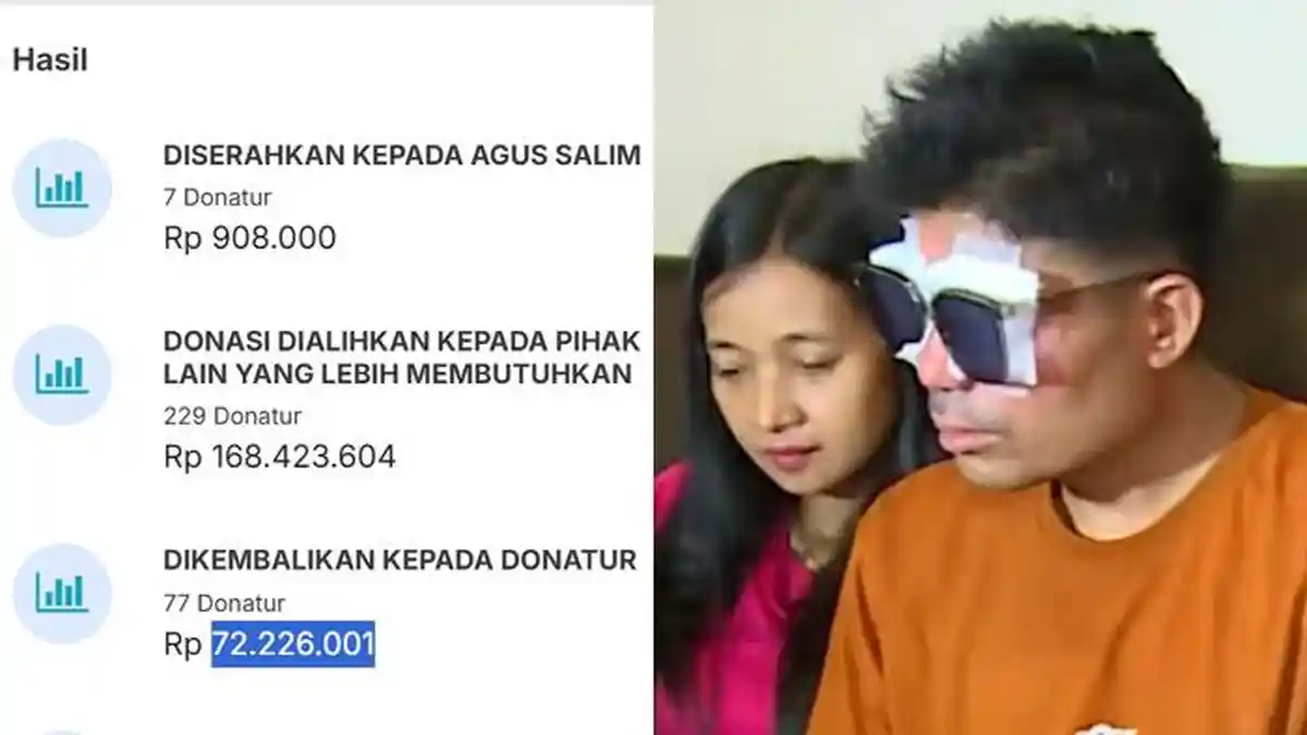 Agus Akhirnya Cuma Dapat Uang Donasi Rp900 Ribu dari Rp1,3 M, Ngambek Tak Mau Operasi: Stres