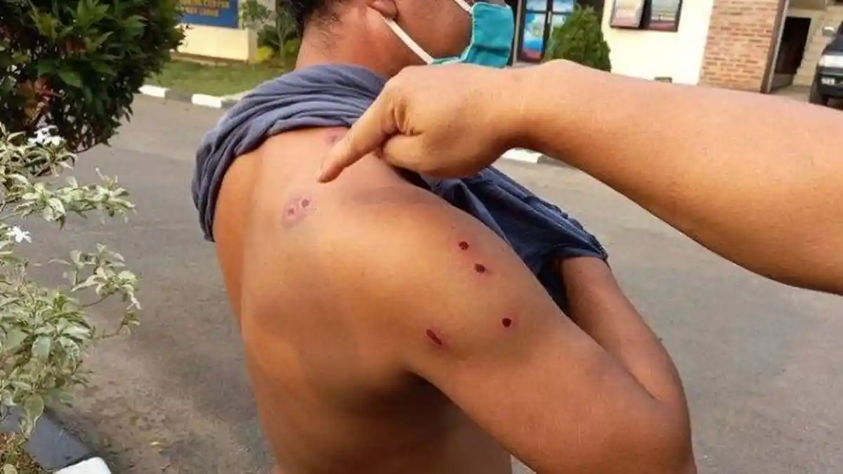 Driver Taksi Online Masih Hidup Setelah Ditembak 10 Kali, Ngaku Pakai Ilmu Kebal Senjata Api
