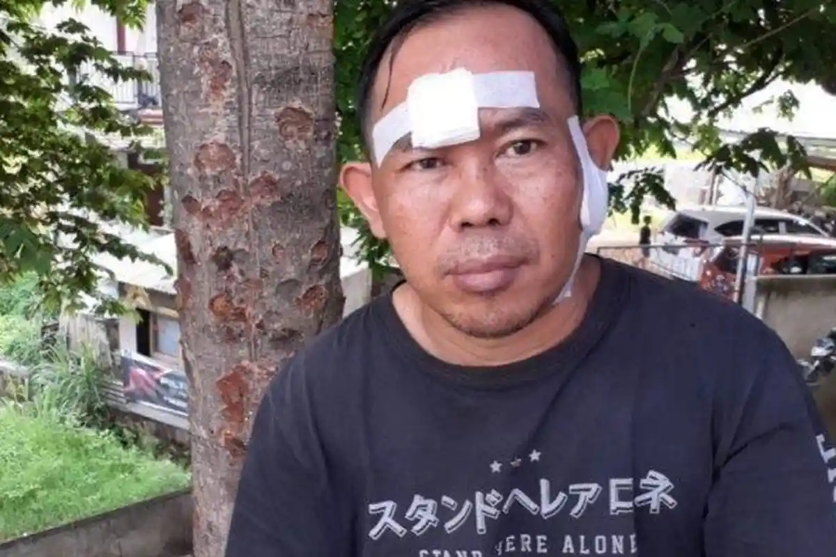 Pedagang Kopi Diberondong 10 Tembakan Air Softgun, Proyektil Bersarang di Dahi, Lengan, dan Pipi