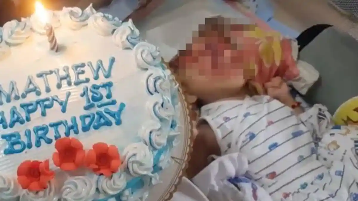 Bayi Tanpa Wajah Rayakan Ulang Tahun Pertama