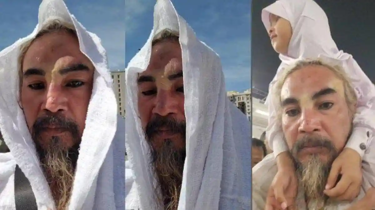 Limbad Ditahan Imigrasi Arab Saudi Saat Umrah Gara-gara Gigi Taringnya Hingga Diteriaki Syaiton